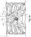 Fig. 97 - ANTENNAS FOR A SUBCUTANEOUS DEVICE