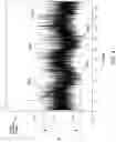 Fig. 06 - Eddy Current Damping Respiratory Waveform and Volume Sensor