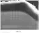 Fig. 07 - System and methods for wireless drug delivery on command