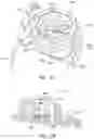 Fig. 19 - Transcutaneous analyte sensor systems and methods