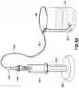 Fig. 10 - DEVICE FOR TRAPPING AN INITIAL FLOW OF BLOOD