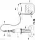 Fig. 11 - DEVICE FOR TRAPPING AN INITIAL FLOW OF BLOOD