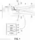 Fig. 02 - Providing a Live-Lead View