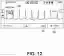 Fig. 13 - Providing a Live-Lead View