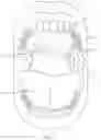 Fig. 10 - TRANSMEMBRANE SENSOR TO EVALUATE NEUROMUSCULAR FUNCTION
