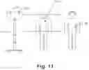 Fig. 16 - SYSTEM FOR RECORDING OF SEIZURES