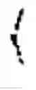Fig. 02 - NOISE FILTERING FOR ELECTROPHYSIOLOGICAL SIGNALS