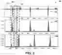 Fig. 04 - NOISE FILTERING FOR ELECTROPHYSIOLOGICAL SIGNALS