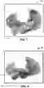 Fig. 08 - NOISE FILTERING FOR ELECTROPHYSIOLOGICAL SIGNALS
