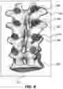 Fig. 07 - Positioning of an X-ray imaging system