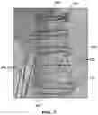 Fig. 08 - Positioning of an X-ray imaging system