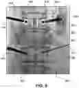 Fig. 09 - Positioning of an X-ray imaging system