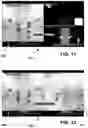 Fig. 12 - Positioning of an X-ray imaging system