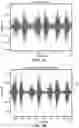 Fig. 03 - METHOD OF DETERMINING RESPIRATORY STATES AND PATTERNS FROM TRACHEAL SOUND ANALYSIS