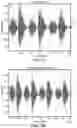 Fig. 04 - METHOD OF DETERMINING RESPIRATORY STATES AND PATTERNS FROM TRACHEAL SOUND ANALYSIS