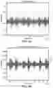 Fig. 05 - METHOD OF DETERMINING RESPIRATORY STATES AND PATTERNS FROM TRACHEAL SOUND ANALYSIS