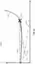 Fig. 16 - Invasive sense measurement in prosthesis installation