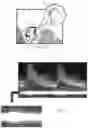 Fig. 04 - Intracranial blood pressure estimation method and device