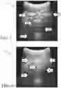 Fig. 03 - Apparatus and method for automatic ultrasound segmentation for visualization and measurement
