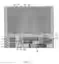 Fig. 04 - OPTIMAL ULTRASOUND-BASED ORGAN SEGMENTATION