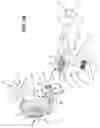 Fig. 03 - Ultrasound transperineal puncture device guide with a pivotable needle holder