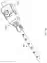 Fig. 08 - Vascular closure device