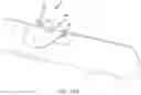 Fig. 28 - Vascular closure device