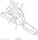 Fig. 35 - Vascular closure device