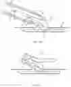 Fig. 41 - Vascular closure device