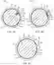 Fig. 05 - Elastic introducer sheath