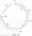 Fig. 22 - APPARATUS AND METHOD FOR MINIMALLY INVASIVE SUTURING