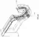 Fig. 65 - APPARATUS AND METHOD FOR MINIMALLY INVASIVE SUTURING