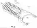 Fig. 90 - APPARATUS AND METHOD FOR MINIMALLY INVASIVE SUTURING