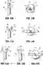 Fig. 10 - SURGICAL SUTURING INSTRUMENTS