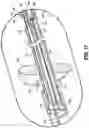 Fig. 15 - SURGICAL SUTURING INSTRUMENTS