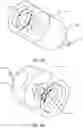 Fig. 08 - EVERSION TOOL AND SIZE GUIDE FOR PERFORMING ARTERIAL MICROVASCULAR ANASTOMOSIS