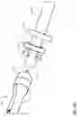 Fig. 17 - EVERSION TOOL AND SIZE GUIDE FOR PERFORMING ARTERIAL MICROVASCULAR ANASTOMOSIS