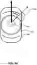Fig. 12 - LIGATION DEVICE WITH A PROTRUSION AND NOTCH FOR LOCKING THE LIGATION DEVICE