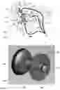 Fig. 02 - Expandable sealing devices and methods