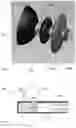 Fig. 05 - Expandable sealing devices and methods