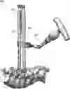 Fig. 01 - Devices and methods for spinal decompression surgery