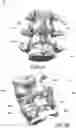 Fig. 03 - Devices and methods for spinal decompression surgery