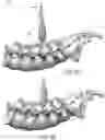 Fig. 08 - Devices and methods for spinal decompression surgery