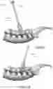 Fig. 09 - Devices and methods for spinal decompression surgery