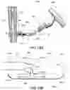 Fig. 26 - Devices and methods for spinal decompression surgery
