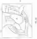 Fig. 03 - Guides and instruments for improving accuracy of glenoid implant placement