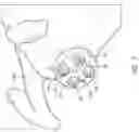 Fig. 05 - Guides and instruments for improving accuracy of glenoid implant placement