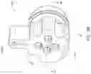 Fig. 13 - Guides and instruments for improving accuracy of glenoid implant placement