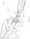 Fig. 22 - Guides and instruments for improving accuracy of glenoid implant placement