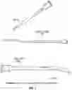 Fig. 02 - SYSTEM FOR RESTORING PATENCY ACROSS AN OBSTRUCTION
